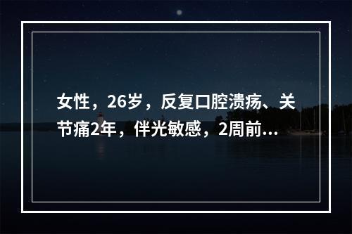 女性，26岁，反复口腔溃疡、关节痛2年，伴光敏感，2周前出现