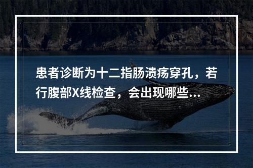 患者诊断为十二指肠溃疡穿孔，若行腹部X线检查，会出现哪些表现