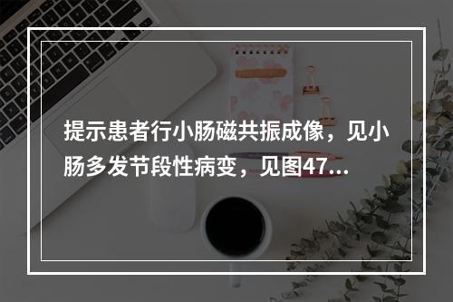 提示患者行小肠磁共振成像，见小肠多发节段性病变，见图47。提