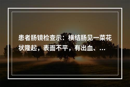 患者肠镜检查示：横结肠见一菜花状隆起，表面不平，有出血、糜烂