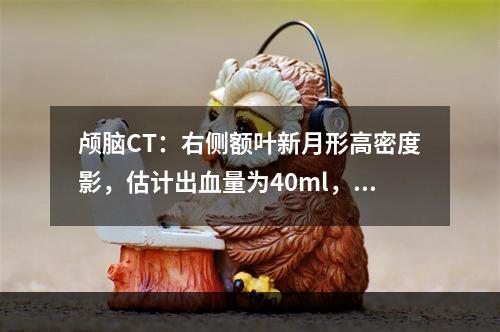 颅脑CT：右侧额叶新月形高密度影，估计出血量为40ml，大脑