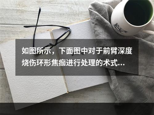 如图所示，下面图中对于前臂深度烧伤环形焦痂进行处理的术式是(