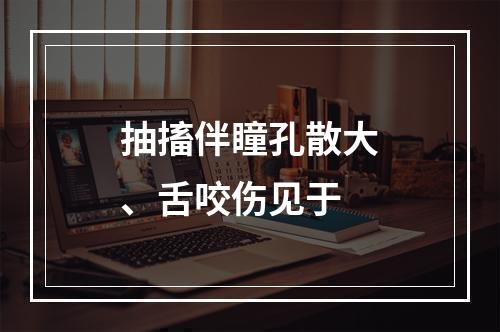 抽搐伴瞳孔散大、舌咬伤见于