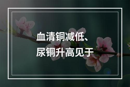 血清铜减低、尿铜升高见于