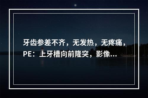 牙齿参差不齐，无发热，无疼痛，PE：上牙槽向前隆突，影像检查