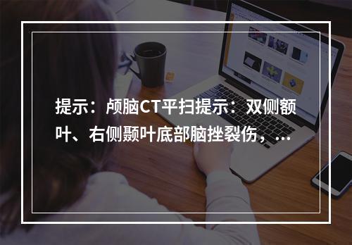 提示：颅脑CT平扫提示：双侧额叶、右侧颞叶底部脑挫裂伤，左侧