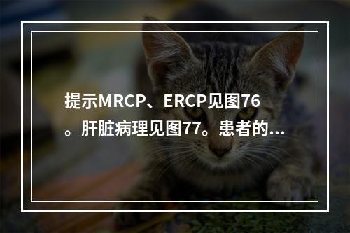 提示MRCP、ERCP见图76。肝脏病理见图77。患者的诊断