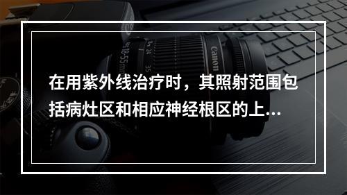 在用紫外线治疗时，其照射范围包括病灶区和相应神经根区的上下肋