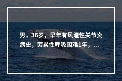 男，36岁，早年有风湿性关节炎病史，劳累性呼吸困难1年，近两