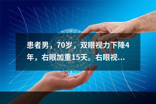 患者男，70岁，双眼视力下降4年，右眼加重15天。右眼视力指