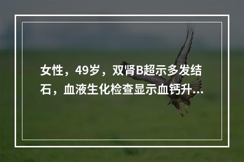 女性，49岁，双肾B超示多发结石，血液生化检查显示血钙升高，