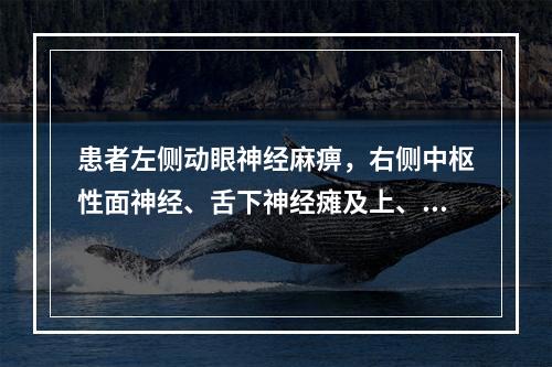 患者左侧动眼神经麻痹，右侧中枢性面神经、舌下神经瘫及上、下肢