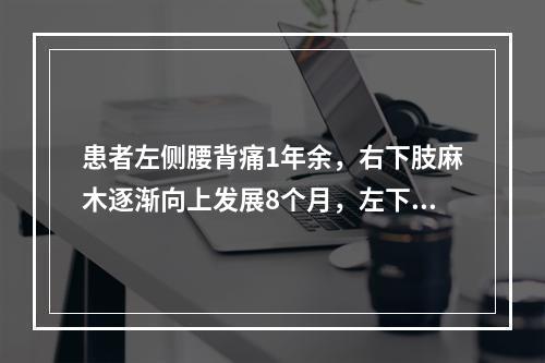 患者左侧腰背痛1年余，右下肢麻木逐渐向上发展8个月，左下肢无