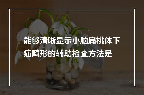 能够清晰显示小脑扁桃体下疝畸形的辅助检查方法是