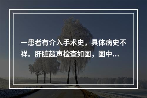 一患者有介入手术史，具体病史不祥。肝脏超声检查如图，图中箭头