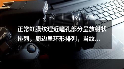 正常虹膜纹理近瞳孔部分呈放射状排列，周边呈环形排列，当纹理模