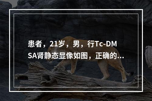 患者，21岁，男，行Tc-DMSA肾静态显像如图，正确的诊断