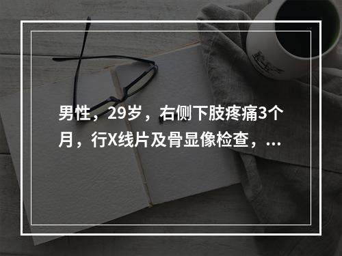 男性，29岁，右侧下肢疼痛3个月，行X线片及骨显像检查，正确