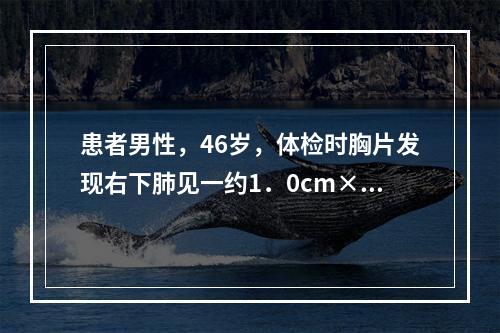 患者男性，46岁，体检时胸片发现右下肺见一约1．0cm×1.