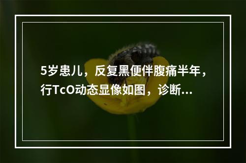 5岁患儿，反复黑便伴腹痛半年，行TcO动态显像如图，诊断是(