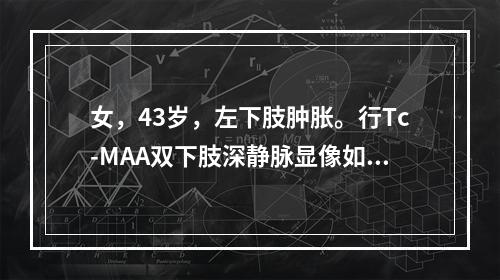 女，43岁，左下肢肿胀。行Tc-MAA双下肢深静脉显像如图，