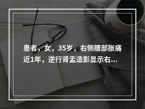 患者，女，35岁，右侧腰部胀痛近1年，逆行肾盂造影显示右侧输