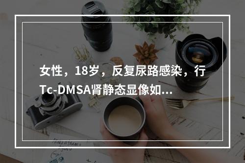 女性，18岁，反复尿路感染，行Tc-DMSA肾静态显像如图，