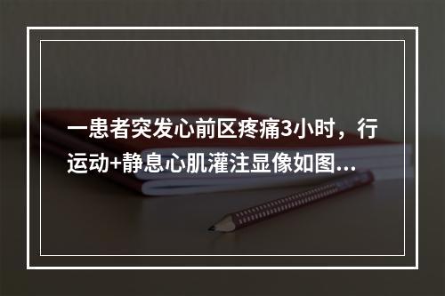 一患者突发心前区疼痛3小时，行运动+静息心肌灌注显像如图，正