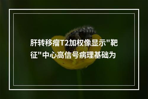 肝转移瘤T2加权像显示