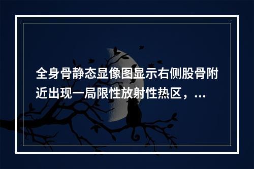 全身骨静态显像图显示右侧股骨附近出现一局限性放射性热区，随后