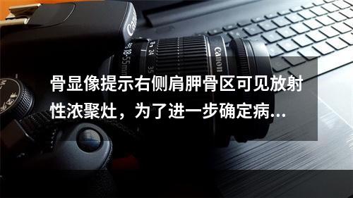 骨显像提示右侧肩胛骨区可见放射性浓聚灶，为了进一步确定病变部