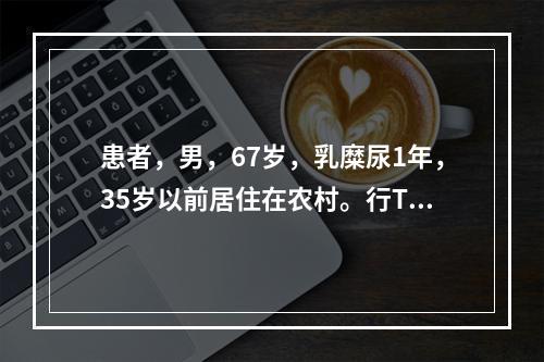 患者，男，67岁，乳糜尿1年，35岁以前居住在农村。行Tc-