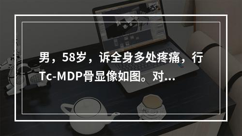 男，58岁，诉全身多处疼痛，行Tc-MDP骨显像如图。对此影