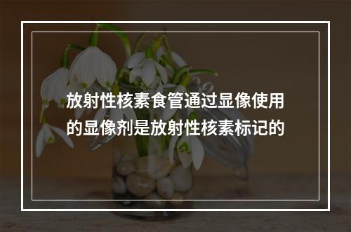 放射性核素食管通过显像使用的显像剂是放射性核素标记的