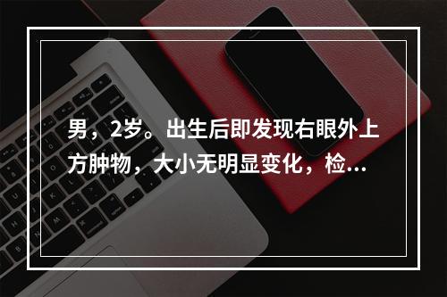 男，2岁。出生后即发现右眼外上方肿物，大小无明显变化，检查发