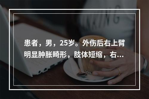 患者，男，25岁。外伤后右上臂明显肿胀畸形，肢体短缩，右腕不