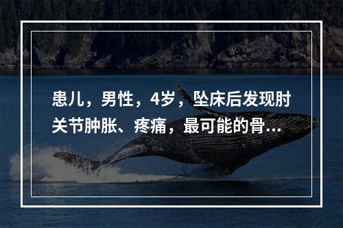 患儿，男性，4岁，坠床后发现肘关节肿胀、疼痛，最可能的骨折是