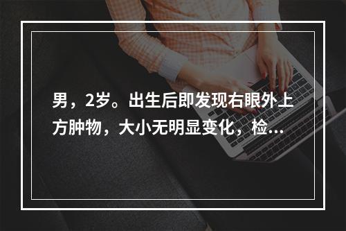 男，2岁。出生后即发现右眼外上方肿物，大小无明显变化，检查发