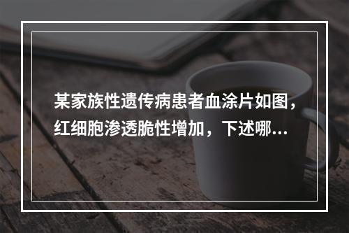 某家族性遗传病患者血涂片如图，红细胞渗透脆性增加，下述哪项不