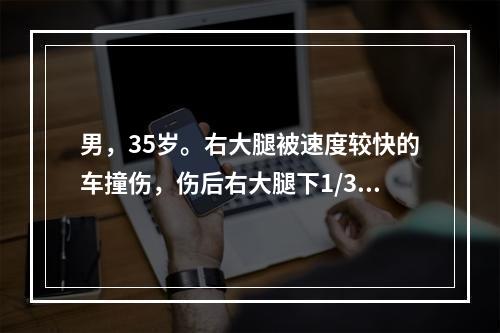 男，35岁。右大腿被速度较快的车撞伤，伤后右大腿下1/3向后