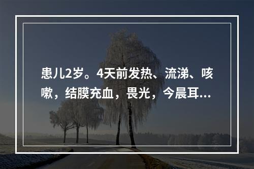 患儿2岁。4天前发热、流涕、咳嗽，结膜充血，畏光，今晨耳后及