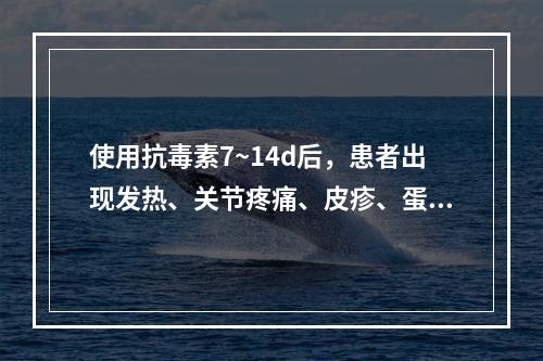 使用抗毒素7~14d后，患者出现发热、关节疼痛、皮疹、蛋白尿