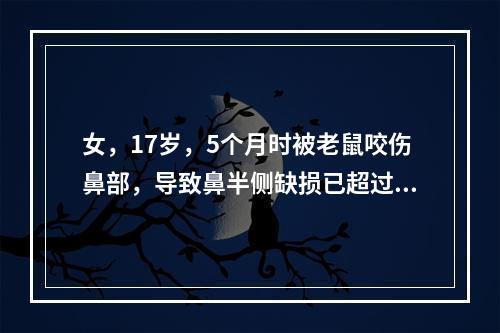 女，17岁，5个月时被老鼠咬伤鼻部，导致鼻半侧缺损已超过中线