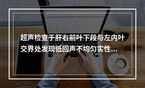 超声检查于肝右前叶下段与左内叶交界处发现低回声不均匀实性肿块