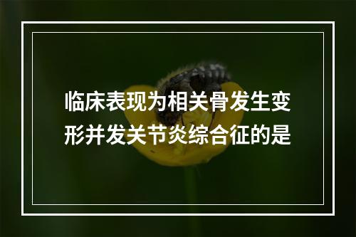 临床表现为相关骨发生变形并发关节炎综合征的是