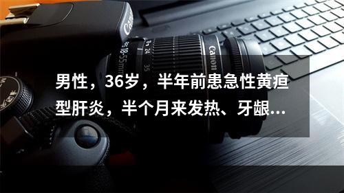 男性，36岁，半年前患急性黄疸型肝炎，半个月来发热、牙龈出血