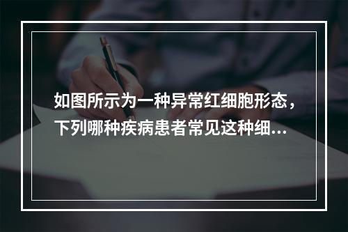 如图所示为一种异常红细胞形态，下列哪种疾病患者常见这种细胞(