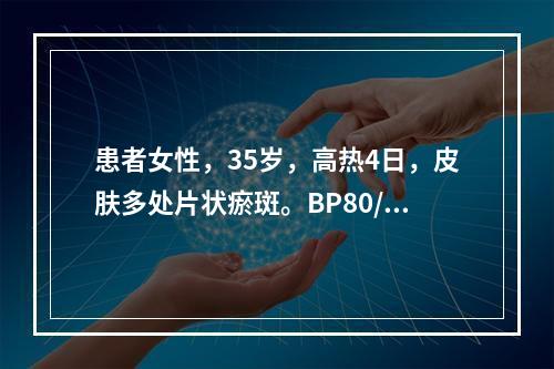 患者女性，35岁，高热4日，皮肤多处片状瘀斑。BP80/45