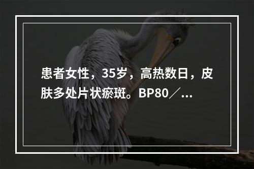 患者女性，35岁，高热数日，皮肤多处片状瘀斑。BP80／45