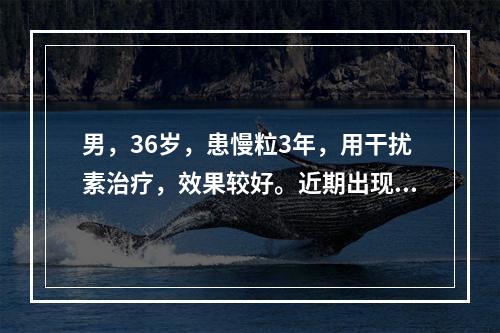 男，36岁，患慢粒3年，用干扰素治疗，效果较好。近期出现乏力